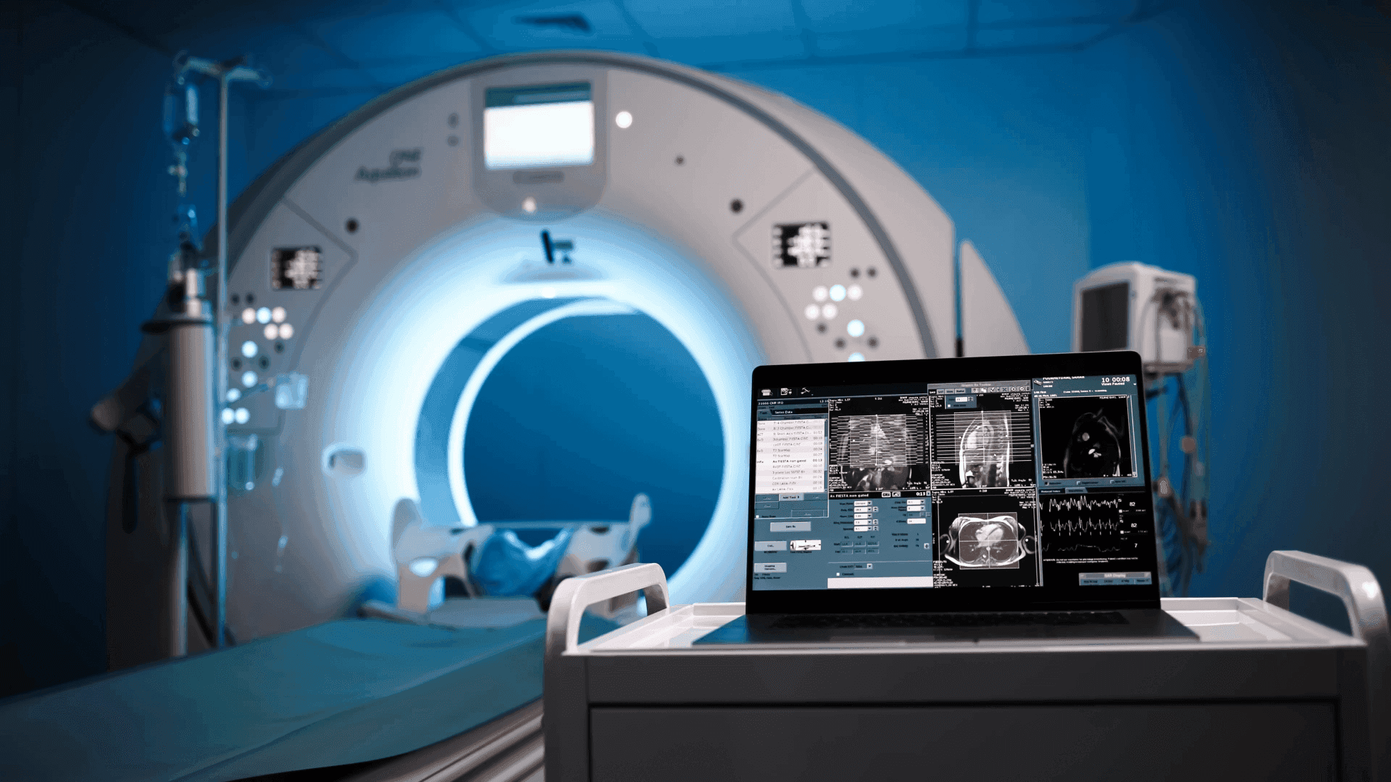 MRI machine in a dimly lit room with a laptop displaying scan images and data on a nearby cart.